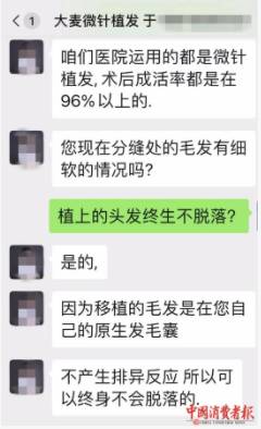 大麦南京的微博，揭秘南京大麦微针植发医院真实体验