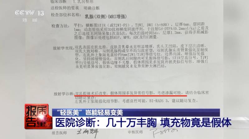 深圳隆胸哪家比较好？深圳假体自体脂肪隆胸专家推荐，整形医院技术费用全面解析