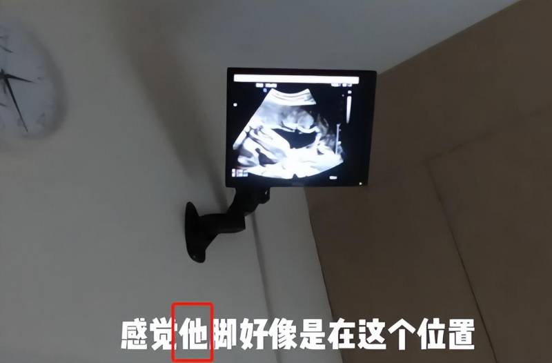 奔跑吧郑恺苗苗！计划生二胎，官宣苗苗怀二胎，期待与郑恺实现“儿女双全”，三年抱俩目标指日可待