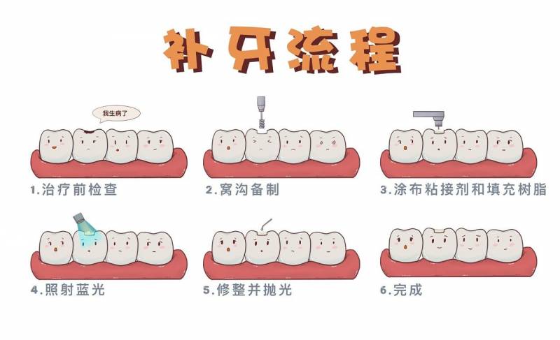 复合树脂补牙，优势显著还是各有利弊？全面解析常用补牙材料优缺点！