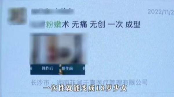 女性私密脱毛全过程，美女耗资2万追求“光洁如玉”，意外发现自然美更胜一筹！