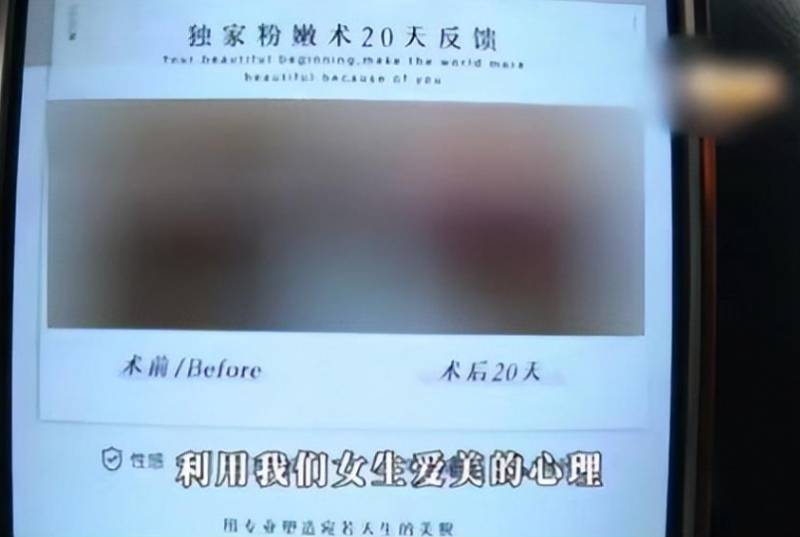 女性私密脱毛全过程，美女耗资2万追求“光洁如玉”，意外发现自然美更胜一筹！