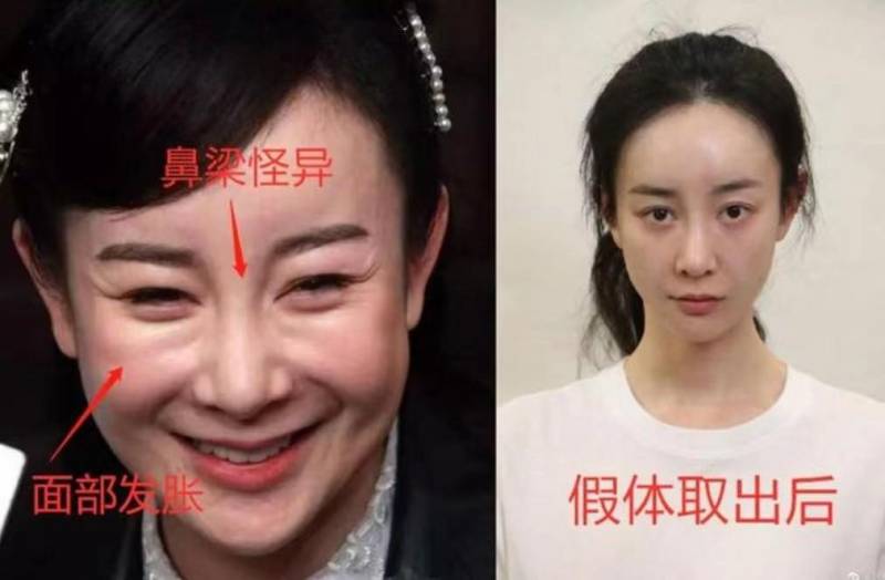 女性丰胸网微博热议，女主播勇敢直播丰胸手术全程，直击畸形审美，引发11000网友关注与思考