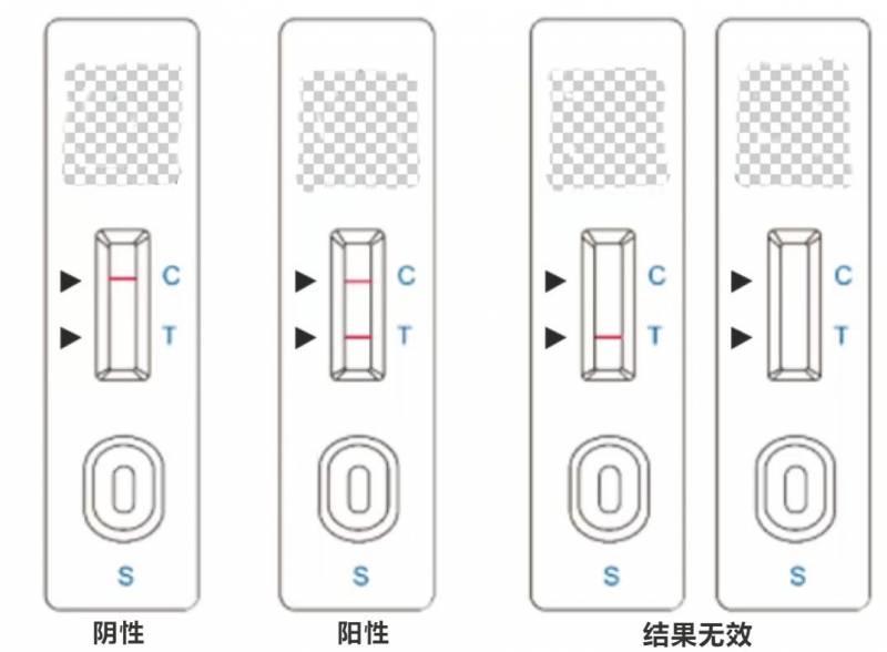 抗原T区颜色深说明病毒载量高？解析T区颜色与病情关系的科学依据