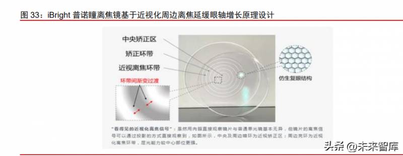 MiSight软性亲水接触镜摘镜指南，安全护理新篇章，呵护双眼的选择之道