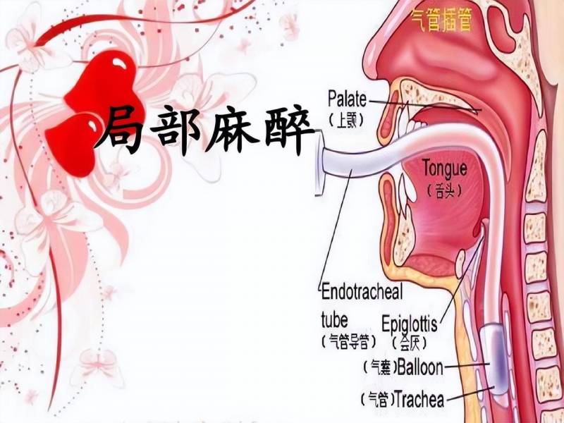 在你被麻醉的30分钟里，身体究竟经历了什么？医生深度揭秘麻醉背后的秘密