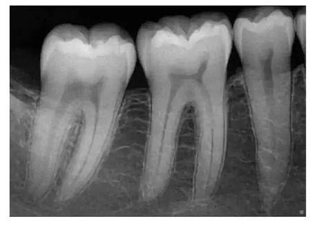 来院免费CBCT口腔拍片检查，精准诊断守护牙齿健康，普陀医生带您深入了解拍片重要性