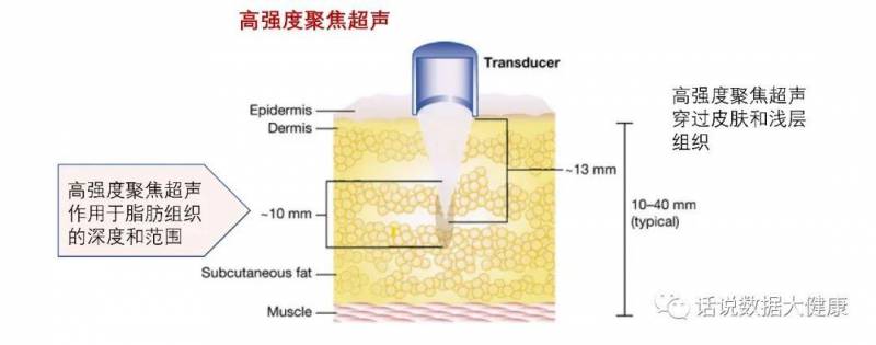 怎么使激光减脂塑性效果更佳？与超声、冷冻减脂对比分析