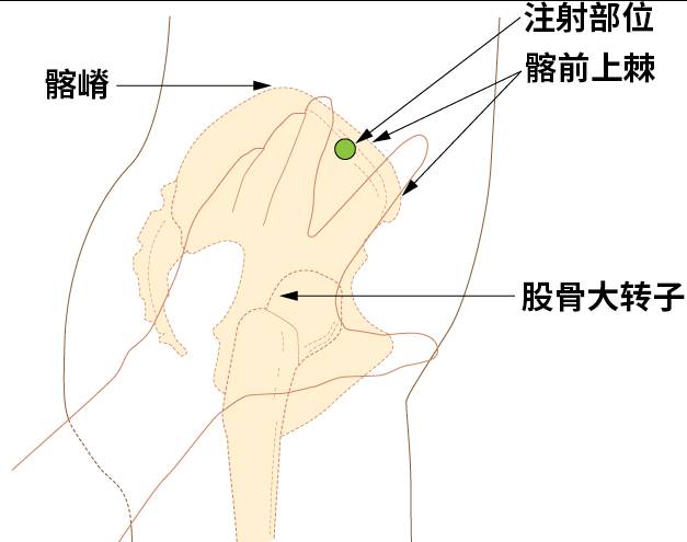 还有人发明了打屁股机器，现代医疗中的替代选择