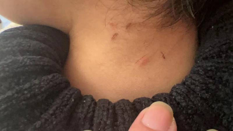 温州3岁男童遭保育员虐待受伤，涉事者已被警方控制